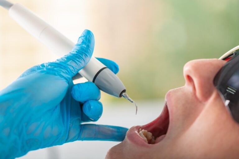 eliminar el sarro dental