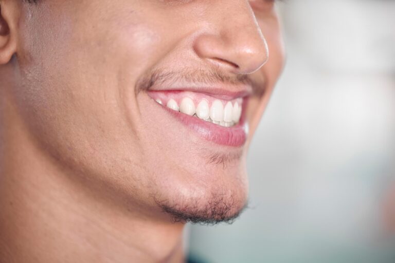 Es posible colocarse implantes dentales sin tornillos