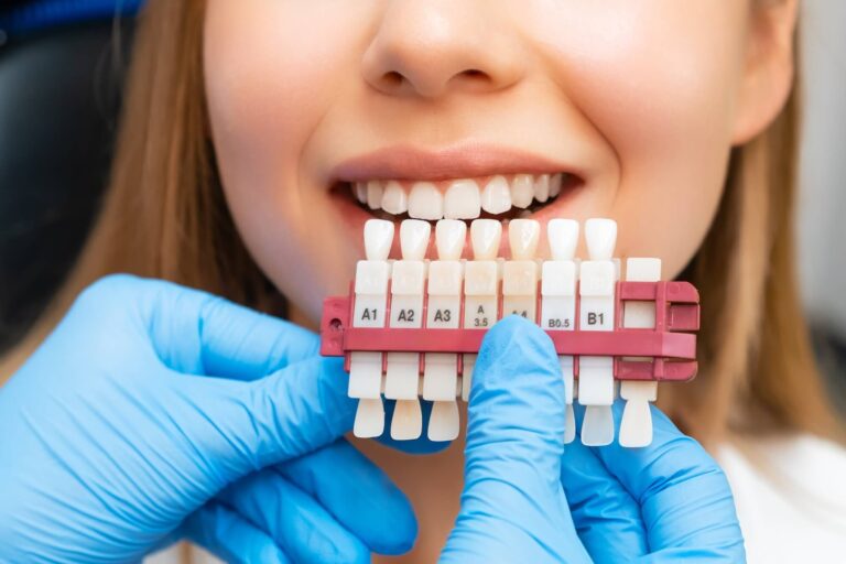 blanqueamiento dental más efectivo