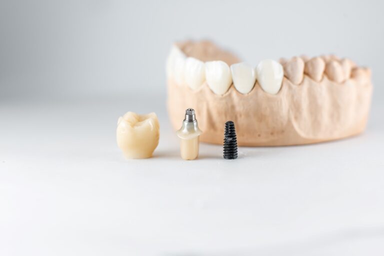 implantes dentales con poco hueso