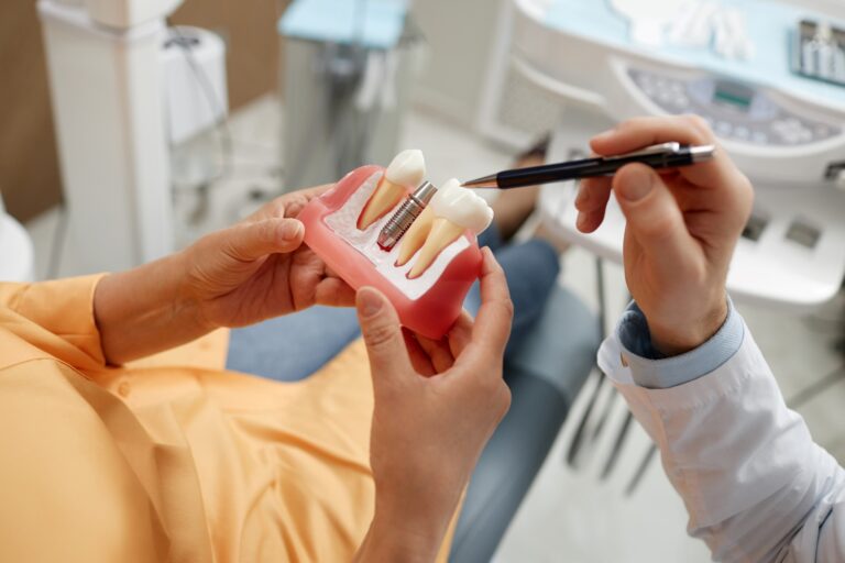 osteointegración de los implantes