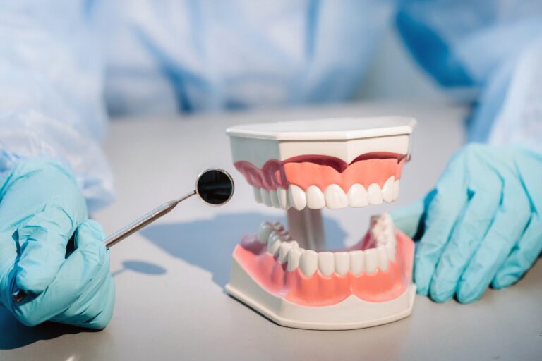 tipos de puentes dentales