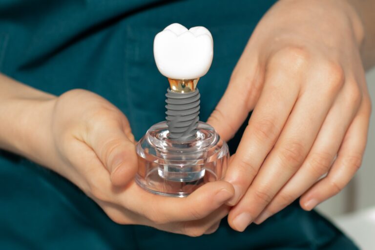 mantenimiento profesional de los implantes