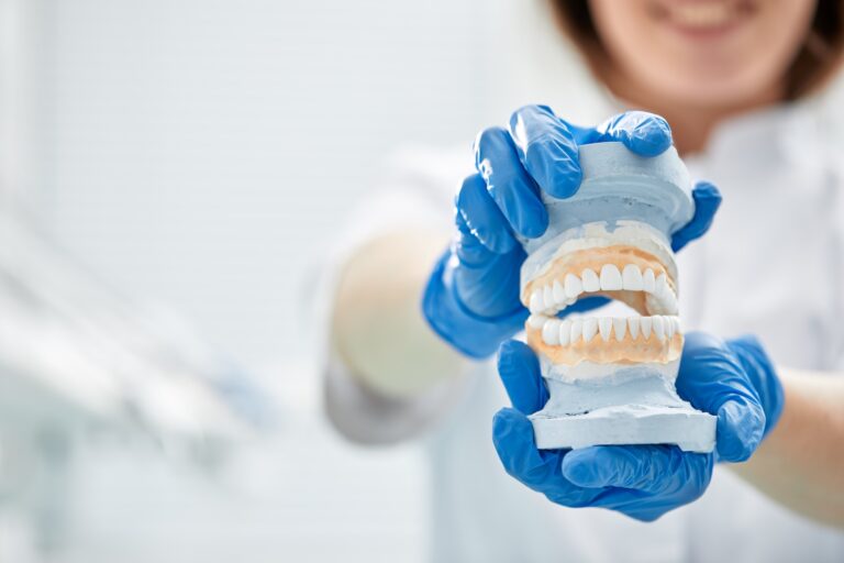 prótesis híbridas sobre implantes