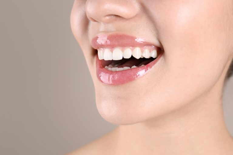 no tienes hueso para implantes