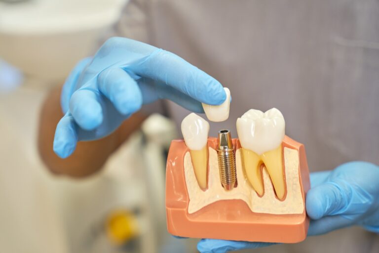 no puedes ponerte implantes