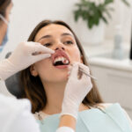 frenillo lingual o labial