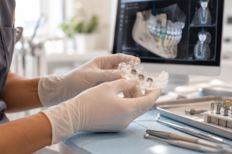 cirugía guiada para implantes